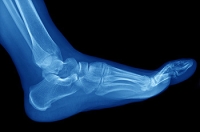 What Can Cause Foot Pain?