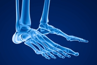 Easing Tarsal Tunnel Syndrome Pain